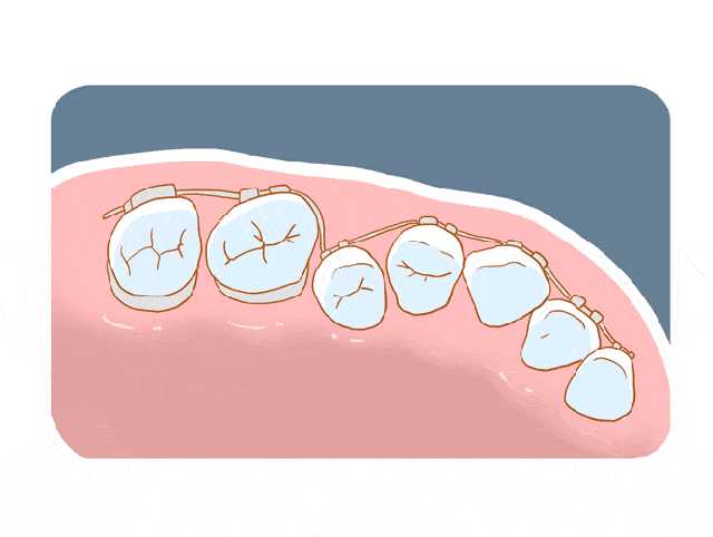 牙齿矫正的小误区!